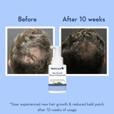 NEW Sealed WishCare Hair Strengthening & Growth Serum - Contains Rosemary Extract, 3% Redensyl, 4% Anagain, 2% Baicapil, Caffeine, Biotin & Rice Water, Makeup Organizers