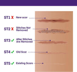 NEW Sealed Silicone Scar Gel Scar Cream - SPF 30 Advanced Scar Gel for Old and New Scars, BB: 03/29