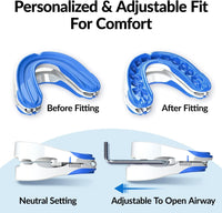 NEW VitalSleep Anti-Snoring Mouthpiece, Smaller Size Recommended for Women, Snoring Solution, Adjustable Jaw Positioning, Personalized Teeth Impressions, USA Made & FDA Cleared Stop Snoring (Blue, Small), Retails $105
