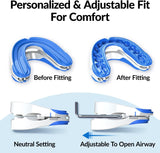 NEW VitalSleep Anti-Snoring Mouthpiece, Smaller Size Recommended for Women, Snoring Solution, Adjustable Jaw Positioning, Personalized Teeth Impressions, USA Made & FDA Cleared Stop Snoring (Blue, Small), Retails $105