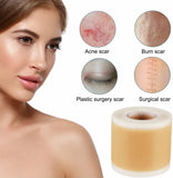 NEW Medical Grade Silicone Scar Sheet, Silicone Scar Tape (1.6”x x120”), Scar Removal Strips for Acne Scars C-Section & Keloid Surgery Scars Sheets Treatment Sheets - 6-8 Month Supply, BB: 06/26