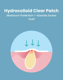 NEW LUXURY 120 Count Skincare Hydrocolloid Clear Patches in 3 Sizes