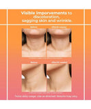 NEW Retails $65, Sealed Retinol Neck Firming Tightening Cream: Neck Firming Cream for Women - Retinol Tightening Skin Creams - Anti Wrinkle Aging for Neck & D collet Orange Canadian, BB: 12/05/26