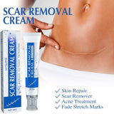 NEW Sealed, Scar Removal Repair Cream, Scar Cream for Face, Stretch Marks Removal Cream for All Skin Types (1PCS)