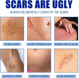 NEW Sealed, Scar Removal Repair Cream, Scar Cream for Face, Stretch Marks Removal Cream for All Skin Types (1PCS)