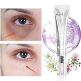 NEW Hanfuji Japan Neutro Soothing Peptide Eye Serum Wrinkle Eye Cream Whitening Dark Circles Eye Cream Puffy Firming Eye Care