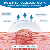 NEW Sealed Hydrocolloid Bandages Roll: 2in x 5ft Ultra Adhesivas & Absorbent & Waterproof Large Hydrocolloid Patches for Wound Care - Hydro Seal Wound Healing Dressing Bandaid Tape (2IN x 5FT), BB: 12/28