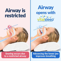NEW VitalSleep Anti-Snoring Mouthpiece, Smaller Size Recommended for Women, Snoring Solution, Adjustable Jaw Positioning, Personalized Teeth Impressions, USA Made & FDA Cleared Stop Snoring (Blue, Small), Retails $105