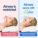 NEW VitalSleep Anti-Snoring Mouthpiece, Smaller Size Recommended for Women, Snoring Solution, Adjustable Jaw Positioning, Personalized Teeth Impressions, USA Made & FDA Cleared Stop Snoring (Blue, Small), Retails $105