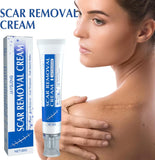 NEW Sealed, Scar Removal Repair Cream, Scar Cream for Face, Stretch Marks Removal Cream for All Skin Types (1PCS)