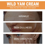 NEW AMALIA Wild Yam Cream, Moisturizing Face Cream with Tea Tree Extract, Body and Face Moisturizer for Dry Skin, 70g/2.47 Oz, EXP: 10/30/2026