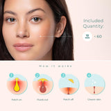 NEW Sealed Pimple Patches for Face & Body - Cosmetic Blemish Stickers, Improve the Appearance of Dots, Bumps, Spots, Whiteheads - Hydrocolloid Stickers - Vegan, Cruelty-Free, Hypoallergenic (12mm), BB: 05/26