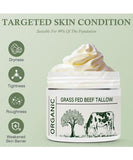NEW Retails $50, Sealed Beef Tallow Tallow Face Moisturizer Beef Tallow for Skin Unscented 100% Organic Beef Tallow Blam Grass Fed Finished Whipped Tallow Face Cream Moisturizer Body Lotion Skin Care for Sensitive Skin
