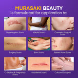 NEW Sealed Silicone Scar Gel Scar Cream - SPF 30 Advanced Scar Gel for Old and New Scars, BB: 03/29