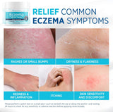 NEW Sealed Roycederm Eczema & Psoriasis Cream for Dry, Itchy Skin – Moisturizer for Sensitive Skin, Eczema, Psoriasis & Dermatitis – 1% Colloidal Oatmeal + Ceramides – Steroid-Free for Adults, Kids & Babies