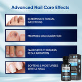 NEW Sealed, Toenail Fungus Treatment, Nail Fungus Treatment for Toenail, Toe Nail Fungus Treatment Extra Strength for Woman and Man, Nail Fungus Treatment 30ML (1 FLOZ)