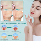 NEW Pumkot Advanced Scar Cream, Silicone Scar Gel, Professional Scar Removal Cream 1.7 oz (50ml)