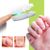 NEW Retails $65, Fungus Therapy Pro: Laser Treatment for Nail Fungus Treatment Eliminate Athlete's Foot Fungus Onychomycosis Compatible with Toenail Fungal Cream