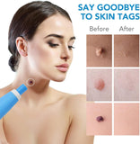 NEW Lerkely Skin Tag Remover, Stielwarts Removal Quick Kit, 2-in-1 Skin Tag Remover Kit for Micro to Large (2 mm-8 mm), Safe and Painless for All Body Parts