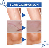 NEW Sealed, Scar Removal Repair Cream, Scar Cream for Face, Stretch Marks Removal Cream for All Skin Types (1PCS)