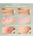 NEW Retails $50, Sealed Beef Tallow Tallow Face Moisturizer Beef Tallow for Skin Unscented 100% Organic Beef Tallow Blam Grass Fed Finished Whipped Tallow Face Cream Moisturizer Body Lotion Skin Care for Sensitive Skin