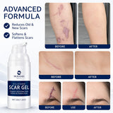 NEW Sealed 100% Silicone Scar Gel Scars Cream - Advanced Scar Gel for Surgical Scars, C-Section, Stretch Marks, Acne, Injury, Burns, Keloids, Old and New Scars 1.06oz(30g) (Maximum Strength 100% Silicone), BB: 2029