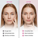 NEW Forehead and Facial Wrinkle Patches: Anti Wrinkle Patches Overnight 144 Pcs