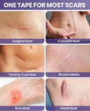 NEW Silicone Scar Sheets, Silicone Scar Tape, Non-Irritating Scar Removal Strips for Surgical Scars, Keloid, C-Section, Tummy Tuck, EXP: 11/11/2028