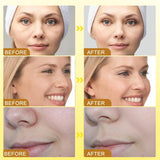 NEW Retails $50, Bee Venom Cream Skin Cream, Wrinkle Removal And Firming, Moisturizing, Lifting Natural Bee Venom Cream for All Parts of The Body