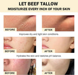 NEW Beef Tallow Skincare, Tallow and Honey Balm, Evil Goods Beef Tallow with 100% Grass-Fed Ingredients, Deep Moisturizer for Sensitive & Dry Skin, Natural Hydration Handmade Whipped Tallow Balm for Face & Body, 4.23oz