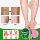 NEW Senzio Miracle Balm, 2025 New Miracle Balm, Soothing Joint Cream for All External Parts of The Body Such As The Back, Hands, Feet (1 Pcs) Bright Day