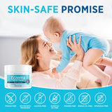 NEW Sealed Roycederm Eczema & Psoriasis Cream for Dry, Itchy Skin – Moisturizer for Sensitive Skin, Eczema, Psoriasis & Dermatitis – 1% Colloidal Oatmeal + Ceramides – Steroid-Free for Adults, Kids & Babies