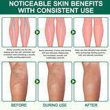 NEW Sealed 2 Pack Miracle Balm for Swollen Legs, Veins Soothing, Relaxing & Comfortable, Botanical Formula with Calendula for Back, Hands, Feet and Body, BB: 01/29