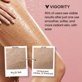 Retails $30+ NEW KP Bump Eraser Body Scrub, Body Exfoliating Scrub, Strawberry Legs Treatment, Exfoliating Body Wash, Strawberry Skin Treatment, Scrubs for Women & Men Exfoliation, Leg Scrub For Strawberry Legs, BB: 01/27