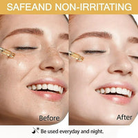 NEW 1pc Ginger Vitamin C Facial Serum, Daily Brightening Moisturizing Glow Serum, Reduce Facial Dark Spots BB: 09/26