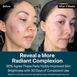 NEW Sealed QRxLabs Glycolic Acid Pads - 20% Resurfacing Pads AHA for Face & Body - Exfoliates Skin Surface and Reduces Appearance of Fine Lines and Wrinkles - Acne Treatment Clearing - Daily Pads - 50ct