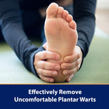 NEW Sealed Compound W Wart Remover One Step Medicated Plantar Foot Pads- 20 Count - With Salicylic Acid, Maximum Strength, Effective Wart Removal, BB: 01/28