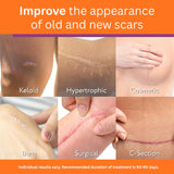 NEW Abera Scar Cream - Advanced Nano Formula for New and Old Scars - Effective for Keloids, Stretch Marks, Surgical Scars, and Acne Marks - Restores Smooth-Looking Skin (1 Box)