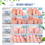NEW Sealed, Toenail Fungus Treatment, Nail Fungus Treatment for Toenail, Toe Nail Fungus Treatment Extra Strength for Woman and Man, Nail Fungus Treatment 30ML (1 FLOZ)