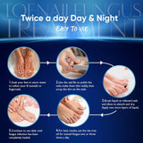 NEW Sealed, Toenail Fungus Treatment, Nail Fungus Treatment for Toenail, Toe Nail Fungus Treatment Extra Strength for Woman and Man, Nail Fungus Treatment 30ML (1 FLOZ)
