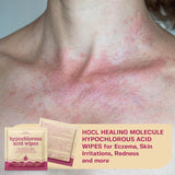 NEW Sealed, BASE LABORATORIES Hypochlorous Acid Wipes for Face & Skin - Facial Cleansing and Daily Skin Repair Hypochlorous Acid Wipes - for Sensitive Skin, Redness, Irritations, Eczema - 75 Wipes, BB: 09/27