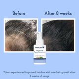 NEW Sealed WishCare Hair Strengthening & Growth Serum - Contains Rosemary Extract, 3% Redensyl, 4% Anagain, 2% Baicapil, Caffeine, Biotin & Rice Water, Makeup Organizers