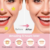 New 300 Piece Colorful Counts Cute Stars Hearts Acne Scars Cover Stickers, Invisible Facial Scars Concealer Makeup Tool
