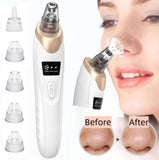 New Blackhead Remover Pore Vacuum, Upgraded Electric Facial Pore Cleaner with 5 Suction Power & 5 Probes, 4 Pimple Popper Tools, USB Rechargeable Blackhead Vacuum Kit for Women & Men