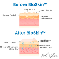 NEW The BloSkin™ Lift, 1 Mask, The No. 1 anti-wrinkle serum in France, Reusable up to 10 times, use once per week, lasts 10 weeks! Removes your double chin! Retails $90