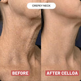 NEW Retails $135+ Sealed Celloa Collagen Neck Patches, smooths neck lines & wrinkles! 5 Patches/box, BB: 04/29