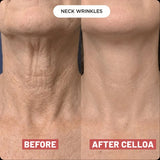 NEW Retails $135+ Sealed Celloa Collagen Neck Patches, smooths neck lines & wrinkles! 5 Patches/box, BB: 04/29