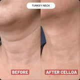NEW Retails $135+ Sealed Celloa Collagen Neck Patches, smooths neck lines & wrinkles! 5 Patches/box, BB: 04/29