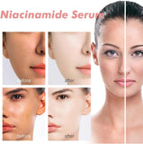 Retails $55+ New Sealed Peach 70 Niacin Serum - 70% Peach Niacinamide Hydrating Face Serum for Daily Clean Beauty Skincare - Women's Face Serum (30ml) Say goodbye to dull skin and hello to radiance!