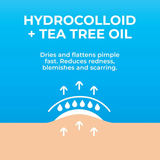 NEW Patchrx Pimple Patches for Face (120 Patches), Hydrocolloid Acne Patches with Tea